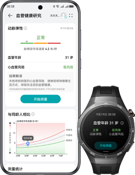华为擎云 H5756 和华为手机的正面图，展示了华为擎云 H5756 筛查动脉硬化和评估血管年龄的功能