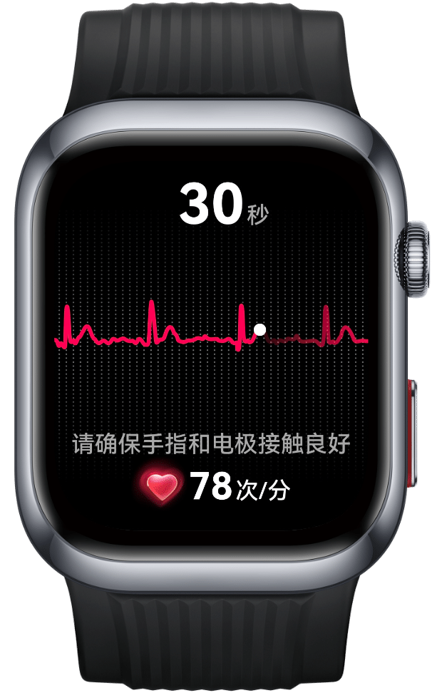 华为擎云 H9D20 的界面图，展示 ECG 心电分析功能