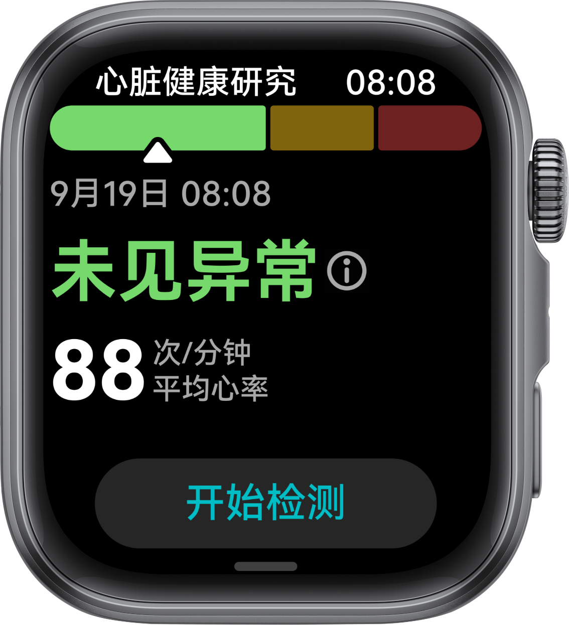HUAWEI Smart Movement S1 正面图，展示了手表识别心律失常的功能